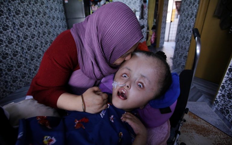 “Doktor kata anak saya tiada harapan untuk hidup kerana tak nampak otak,” – Ibu