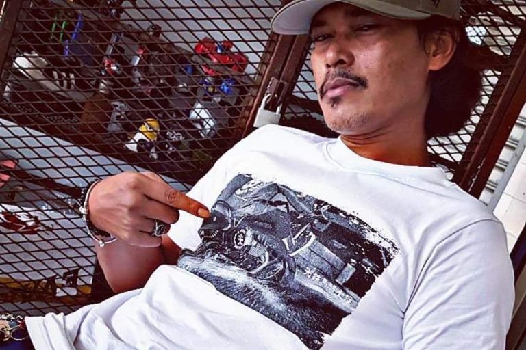 Bahana berus lukisan, Joey Daud alami ‘trigger finger’