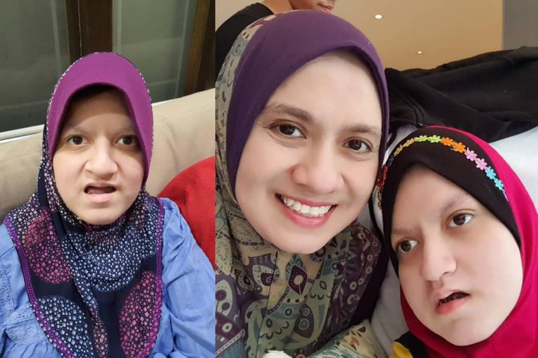 Ketahui tanda Epilepsi dan sawan. Wanita ini kongsi cerita anak diserang epilepsi sejak usia lima bulan
