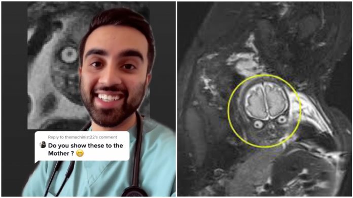 mri bayi