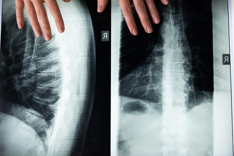 Tulang dan pengurusan berat badan