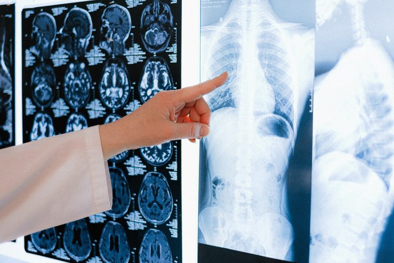 Tulang dan pengurusan berat badan