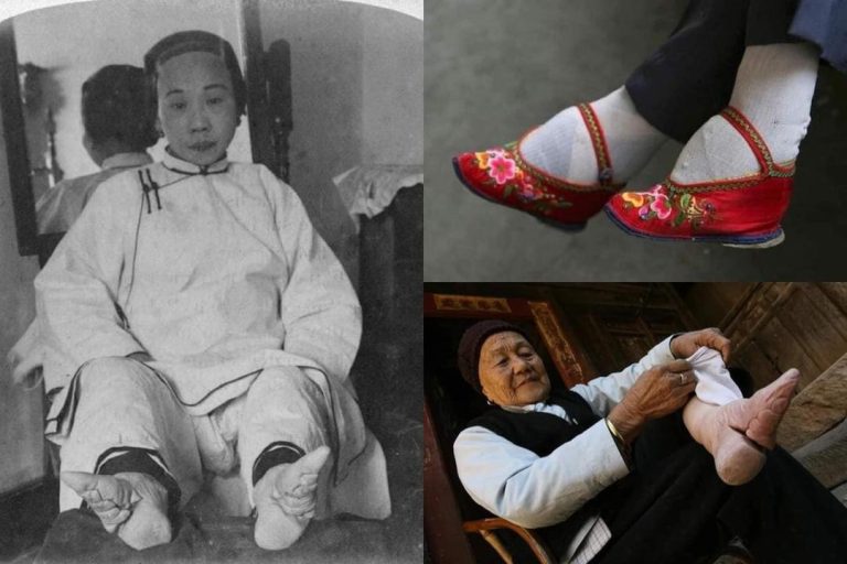 bungkus kaki