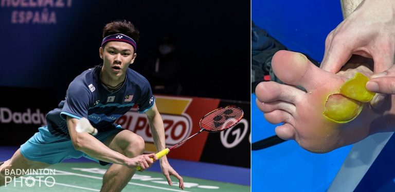Kecederaan kaki halang Zii Jia buru gelaran juara dunia