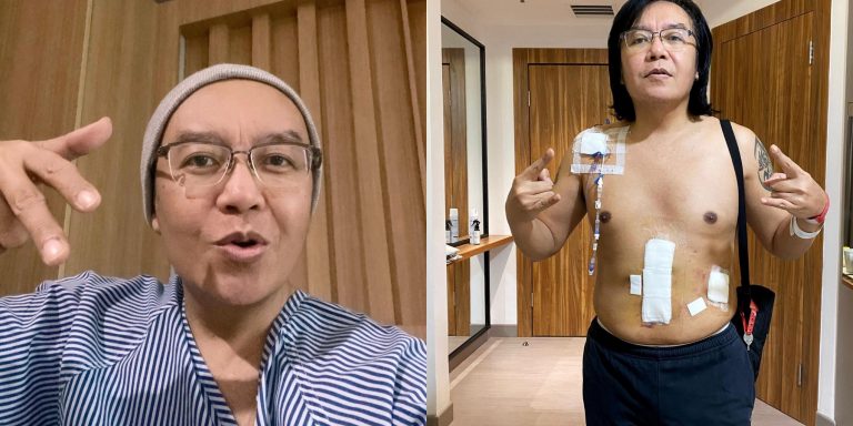 Hasil 6 kali rawatan kimoterapi, Ari Lasso disahkan bebas kanser!