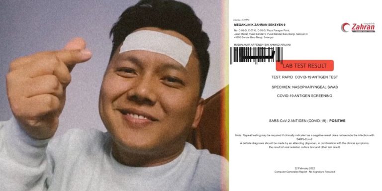 “Sakit tekak bangun tidur,” – Radin sahkan positif Covid-19