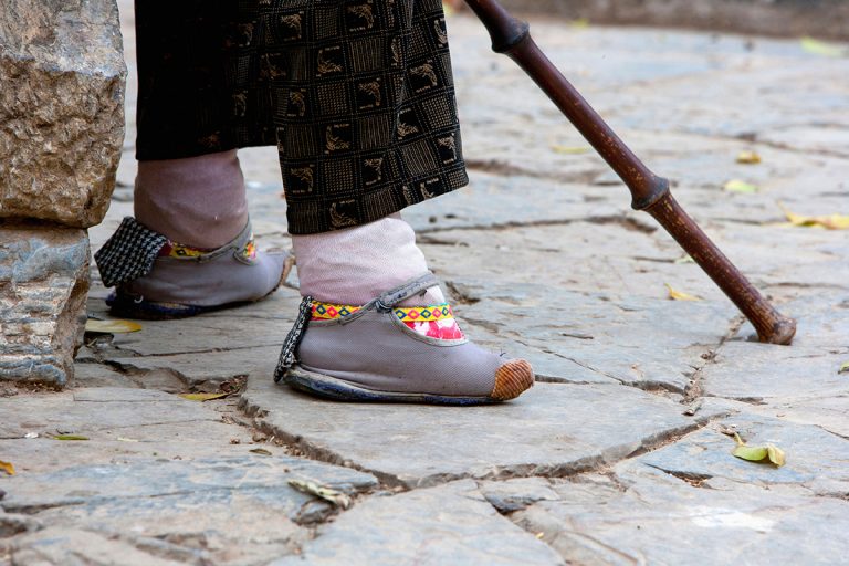 Ikat kaki untuk cantik, tradisi kuno yang bersifat kejam terhadap wanita sehingga menyebabkan kecacatan & kematian