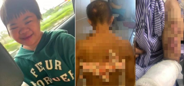 Bella buat isyarat tangan diikat, gosok mata sambil sebut ‘cili’ – Pakar psikiatri