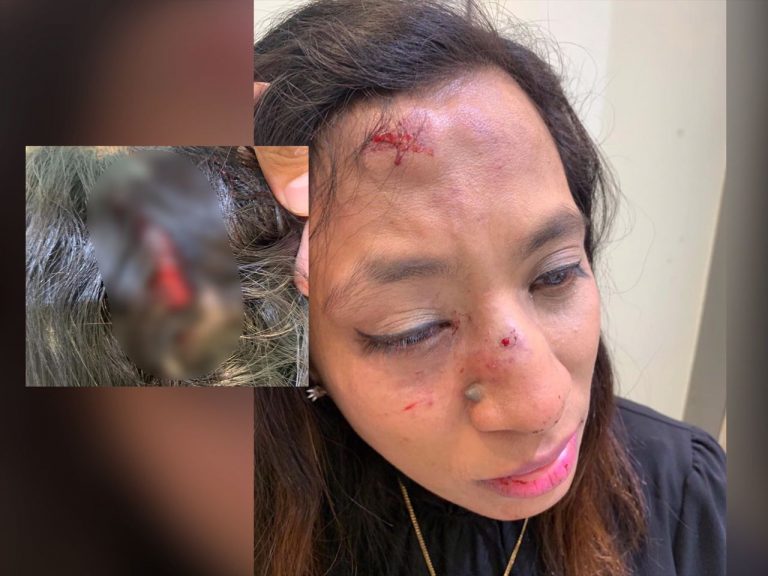 Polis cari geladangan pukul, samun wanita