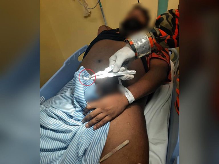 Lelaki Rohingya tahan sakit lebih sejam cincin sangkut pada kemaluan