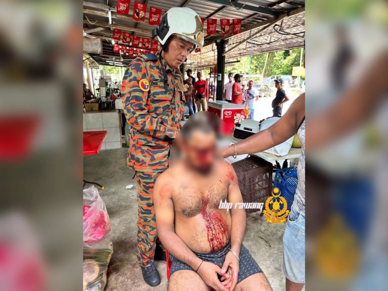 Lelaki India cedera ketika mandi di Taman Rimba Kanching