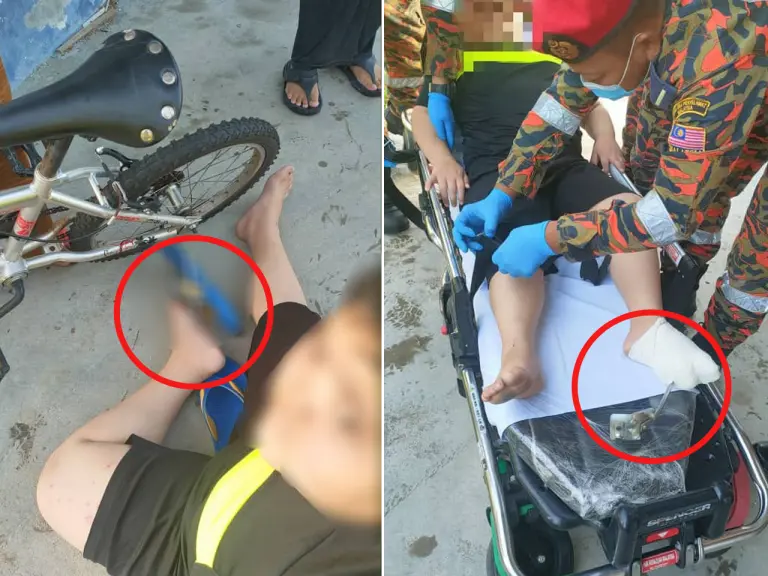 Budak 9 tahun mengerang kesakitan tertusuk tongkat basikal
