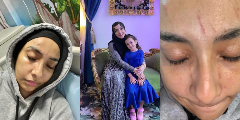 Anak hampir diculik, Lufya cedera dipukul dengan kayu