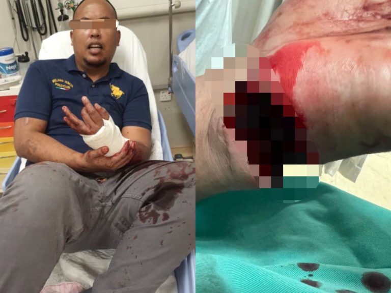 Dua anggota polis cedera parah dilibas parang