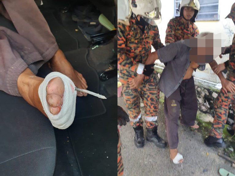 Warga emas tertusuk paku di kaki kanan