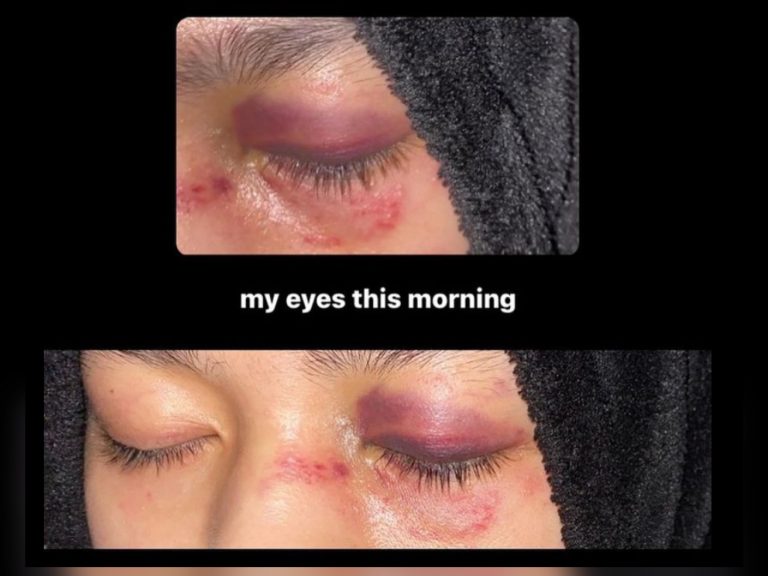 Polis tahan lelaki dipercayai pukul anak tiri