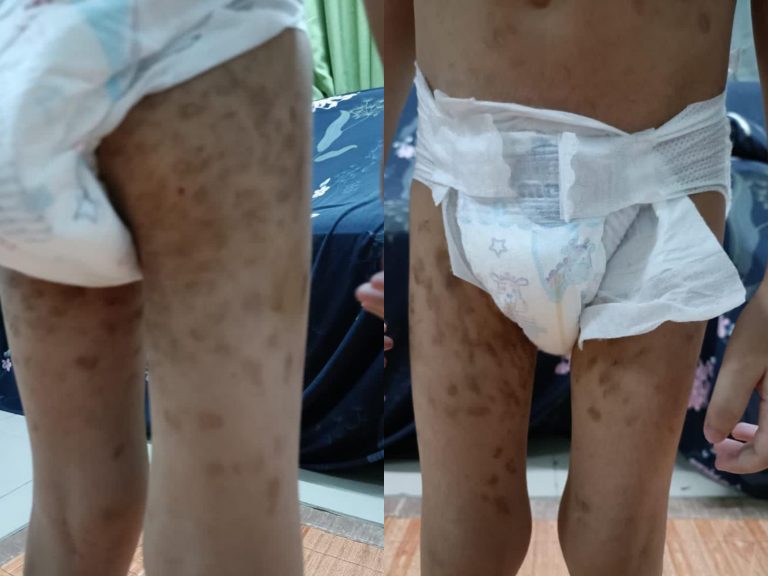 Pengawal keselamatan dera anak angkat ditahan polis