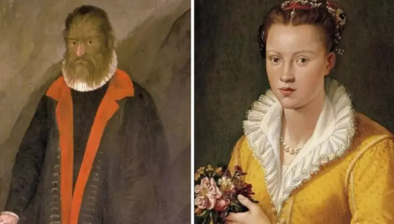 Ini kisah Pedro, lelaki berbulu yang menjadi inspirasi cerita ‘Beauty & The Beast’
