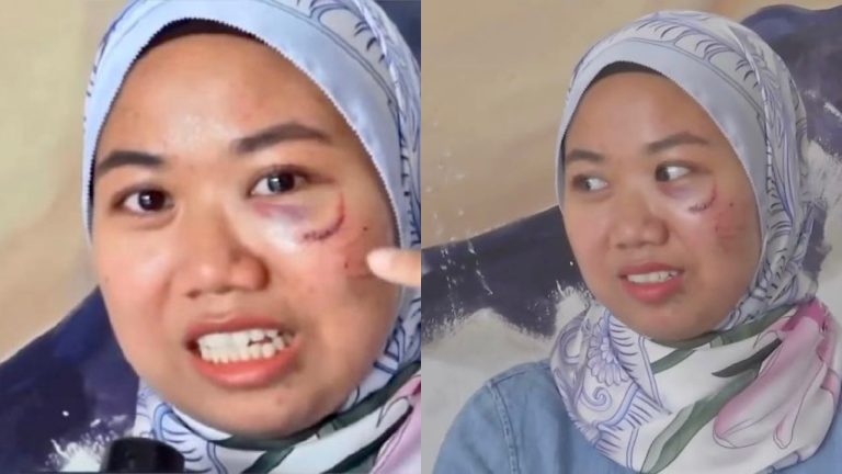 Dah lama kena tindas dengan Hafidz Roshdi, Nurul Shuhada anggap kena 10 jahitan lagi sakit daripada melahirkan anak
