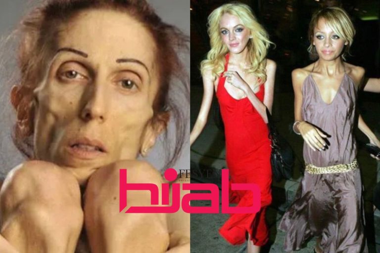 PART I : Anoreksia & Bulimia: Taksub nak kurus, sanggup jolok tekak untuk muntah. Berisiko maut
