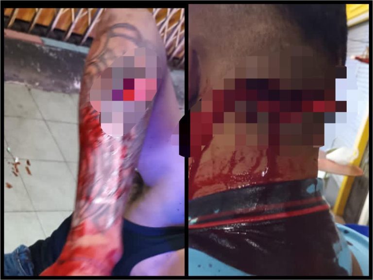 Cuba ganggu isteri orang, dua lelaki parah ditetak