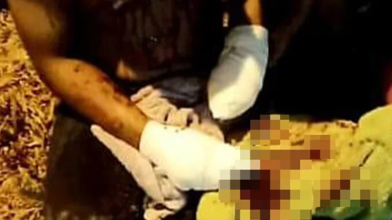 Lelaki putus pergelangan tangan, jari hancur bancuh mercun buatan sendiri