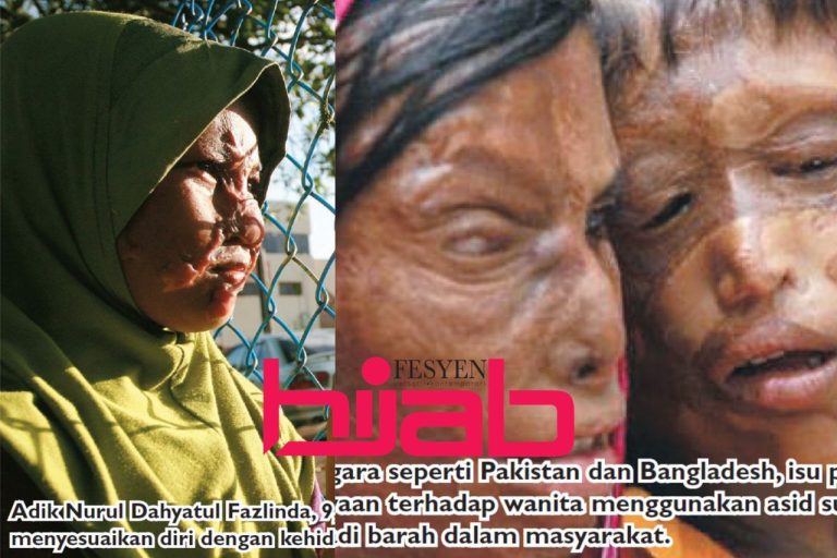 Diserang guna asid, apa yang perlu dilakukan? Jenayah secara rambang dan balas dendam
