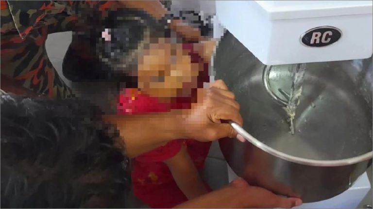 Lengan budak perempuan lebam, 20 minit tersepit mesin penguli