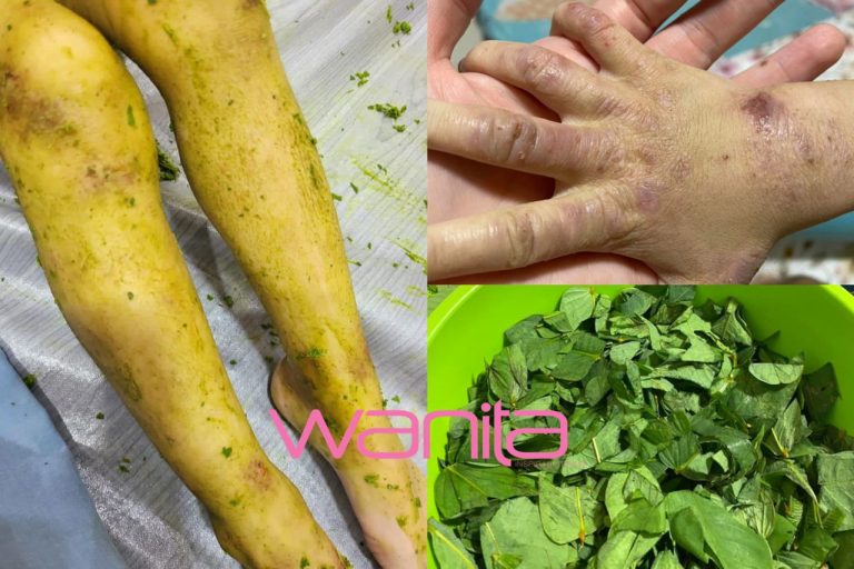 Guna daun solok untuk hilangkan ekzema. Mudah je, hanya kisar dan sapu. Natural, selamat dan jimat