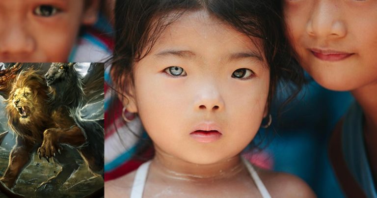 Bagaikan makhluk dalam mitologi purba, digelar ‘manusia Chimera’ kerana ada ‘individu’ lain dalam tubuh mereka