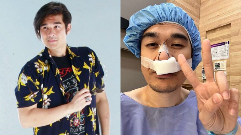 Dazrin Kamarudin jalani pembedahan hidung sebab masalah sinus-“Rasa nak mati..saya berasa sangat panik”