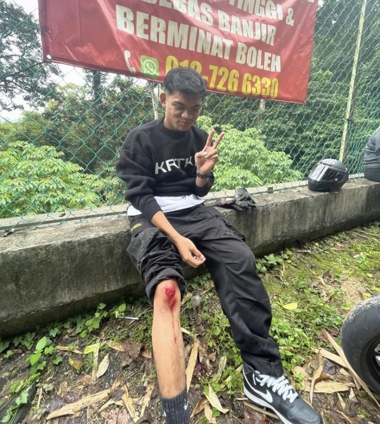 Zynakal kemalangan motosikal ketika konvoi, cedera kaki & tangan