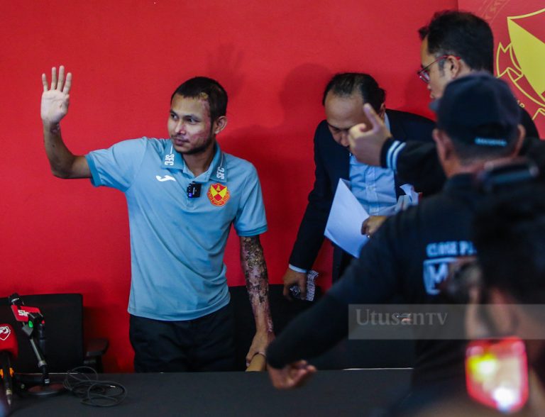 Faisal Halim masih jalani proses fisioterapi, tangan kiri belum pulih 100 peratus