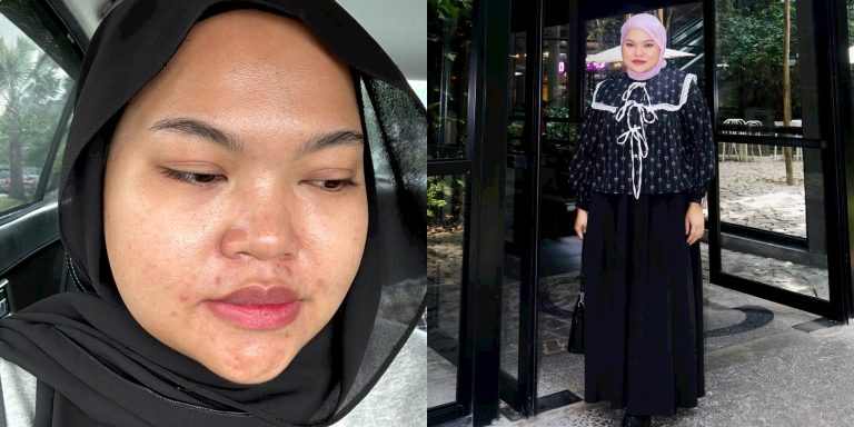 Muka pernah ‘breakout’ & berjerawat, pempengaruh Amalina Jasmin teruja diberi peluang jadi sebahagian wajah #PastelsCommunity