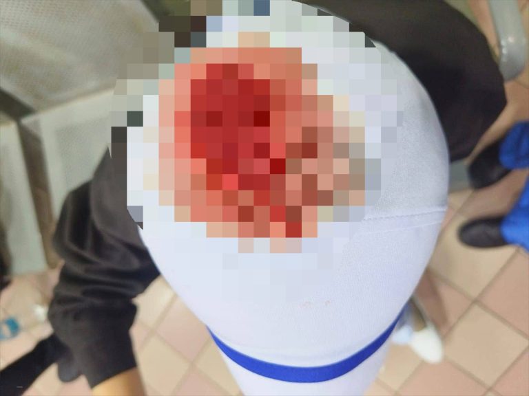 Lelaki kurang siuman pukul jururawat sampai berjahit kepala ditahan polis