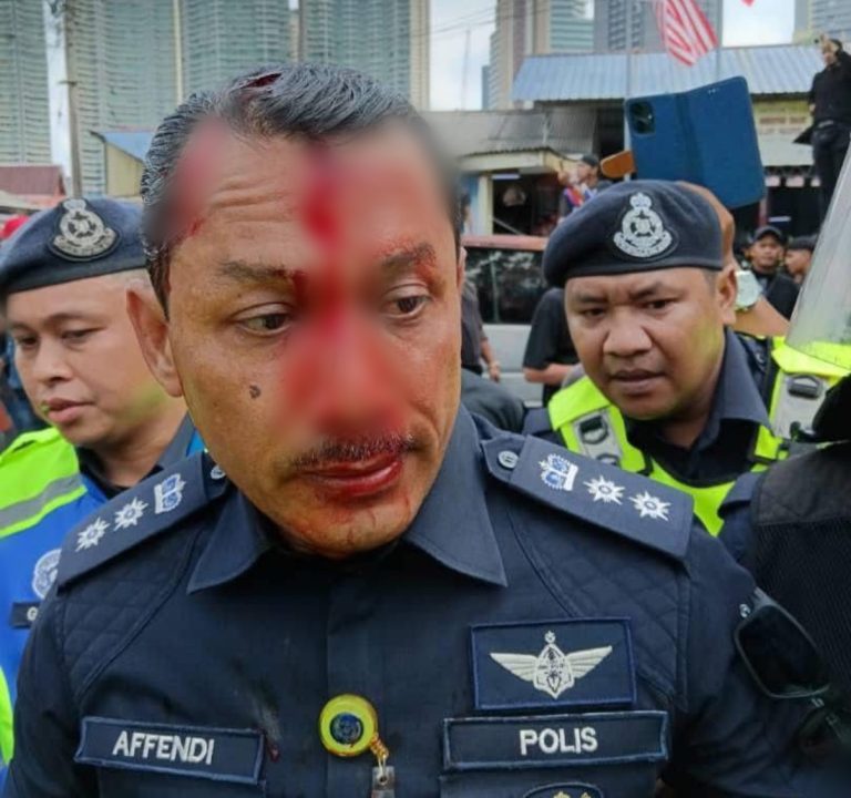 Operasi pengosongan bangunan Kampung Sungai Baru tegang, OCPD Dang Wangi cedera dibaling batu